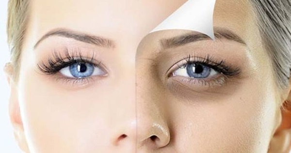 Common Reasons Behind Dark Circles in Islamabad
