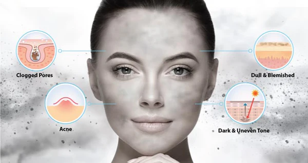 Pollution effects on skin in Islamabad
