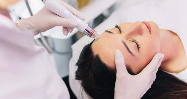 HydraFacial for Acne-Prone Skin