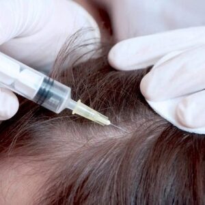 Dermatologist for Hair Loss