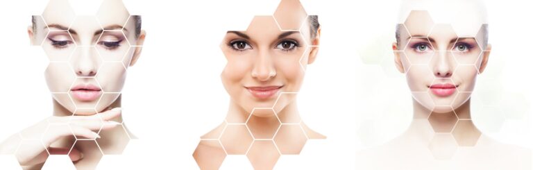 Glutathione with Hyperpigmentation