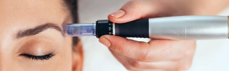 How Long Do Microneedling Results Last