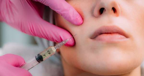 Benefits of Sculptra Fillers