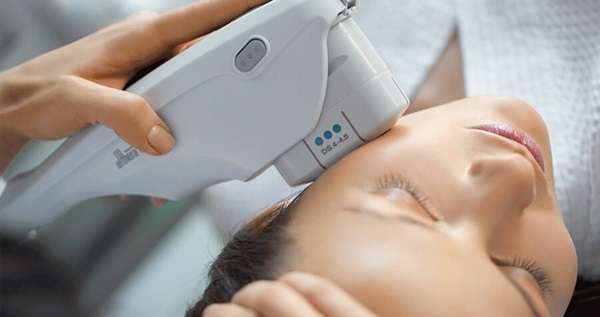 Can Ultherapy Be Used Under the Eyes