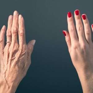 Hand Wrinkles
