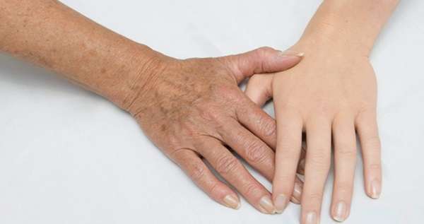 Hand Wrinkles Treatment in Islamabad