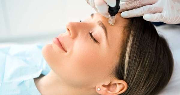Mesotherapy vs Microneedling Which Treatment Is Better
