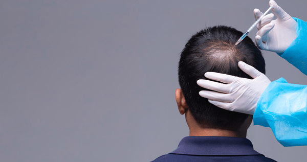 What Is the Most Successful Hair Treatment?