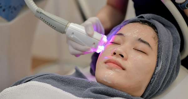 Laser Whitening vs. Peels: What’s More Effective?