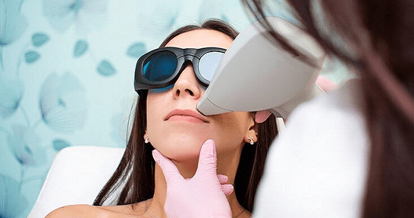 Is Laser Hair Removal Safe for Face?