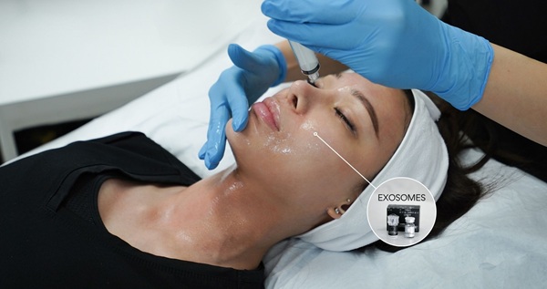 Anti-Aging Solutions with Exosome Therapy