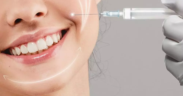 Dermal Fillers to Create the Perfect Smile