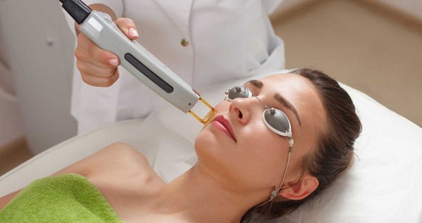Types of Laser Treatments for Face
