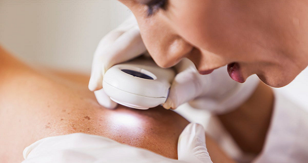 Expert Diagnosis and Treatment for Skin Conditions