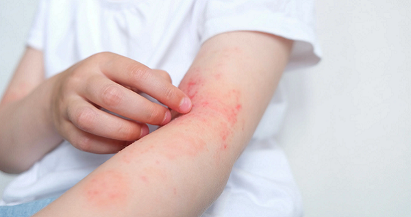 Itchy Skin Causes and Dermatologist-Approved Treatment Options