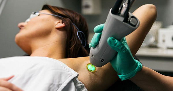 Aftercare Tips for Laser Hair Removal for Smooth Skin Results