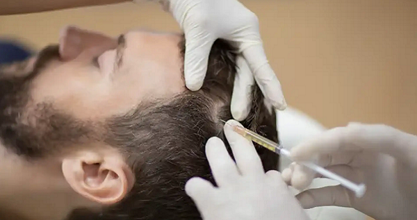 How Many PRP Sessions Are Needed for Best Results?