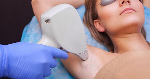 Permanent Hair Removal with Laser: How Many Sessions Are Needed?