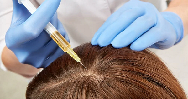 Stem Cell Therapy for Hair Growth vs PRP: Which is Better?