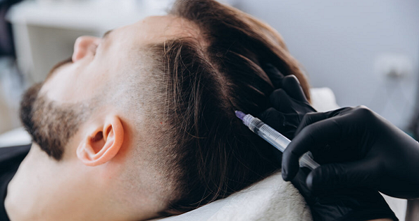 PRP Hair Treatment for Early Hair Loss: Is It Worth It?