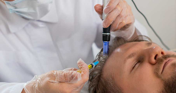 Can Exosome Therapy Help Treat Different Types of Hair Loss?