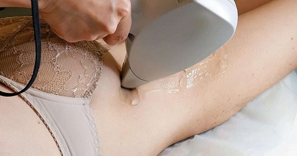 Can Laser Hair Removal Help with Ingrown Hairs?