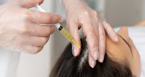 Can PRP Treatment Help with Thinning Hair?